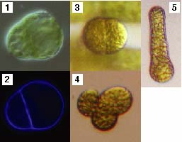 asymmetric cell division