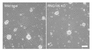 Phase contrast images of primary cultured neurons