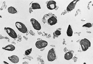 ヒト精液洗浄サンプル。バルク（集団）ではクロマチン状態を正確に評価できないことは一目瞭然です。