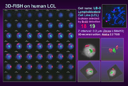 3D-FISH on human LCL