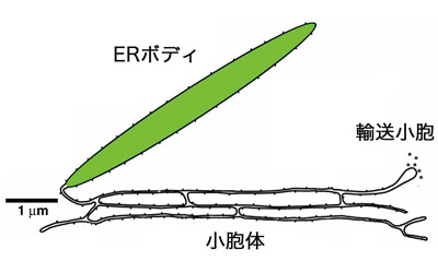 ERボディ模式図