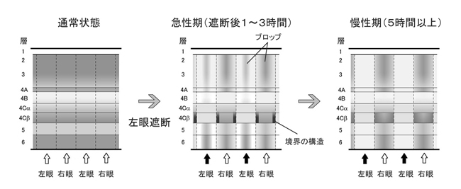 片眼(左眼)遮断前後の一次視覚野における神経活動の変化