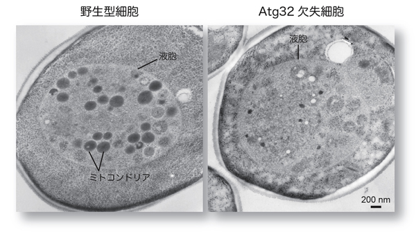 選択的ミトコンドリア分解の電子顕微鏡解析