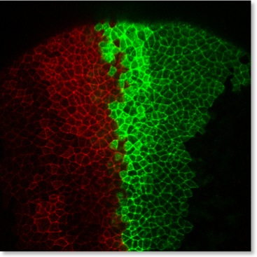 Neural tube closure-00