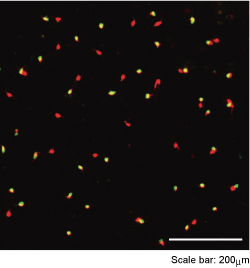 SIPG1発現網膜神経節細胞