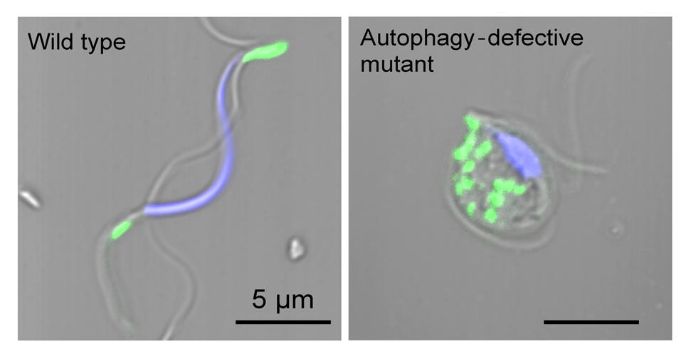 Dynamic rearrangement and autophagic degradation of the mitochondria during plant spermiogenesis