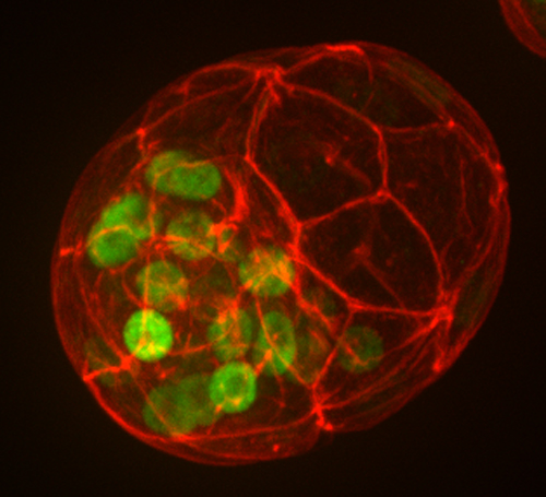 マウス胚盤胞における転写因子Nanogの発現 