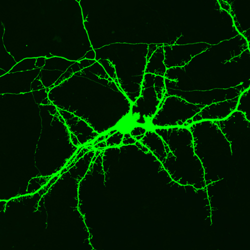 緑色蛍光タンパク質で光らせたマウス神経細胞 